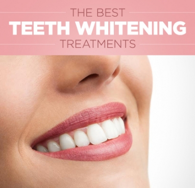 Tips to Achieve Whiter Teeth